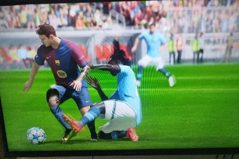 Leve contusão sofrida no final da partida contra o City