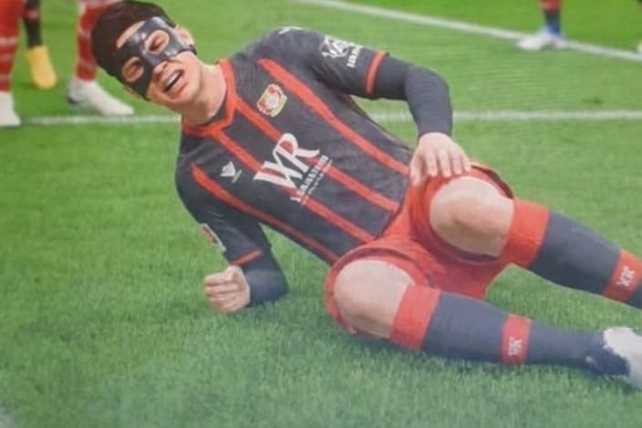 Me lesonei grave no joelho ficarei fora de 3 meses me assentando