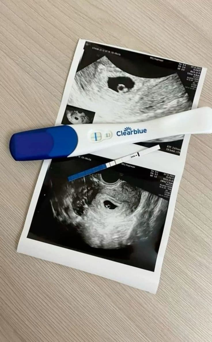 Nuestro pequeño campeón ya tiene nombre: Esteban González. 💙👶🏻