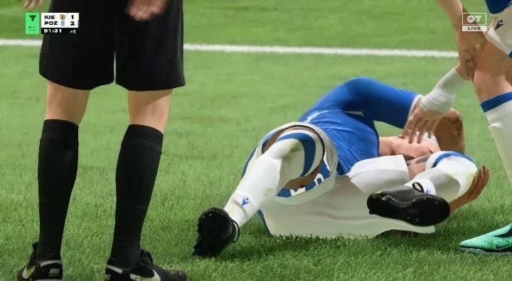 Infelizmente tive uma contusão: lig anter cruzado/ Muito triste por não poder jogar😔