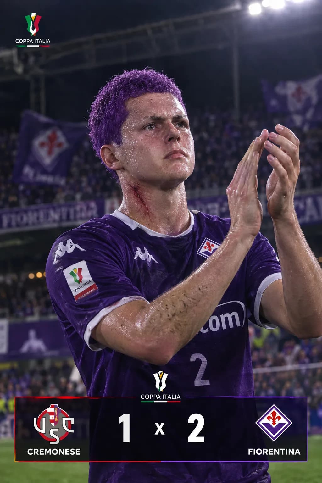 Seguimos em frente Na copa 🔥🔥 +1⚽ 9,3🗒️ +1🟨 Melhor da partida✨ Seguimos firme em frente na copa